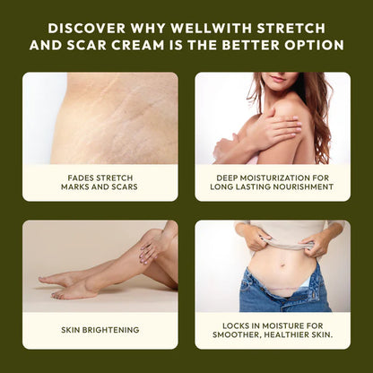Stretch & Scar Cream